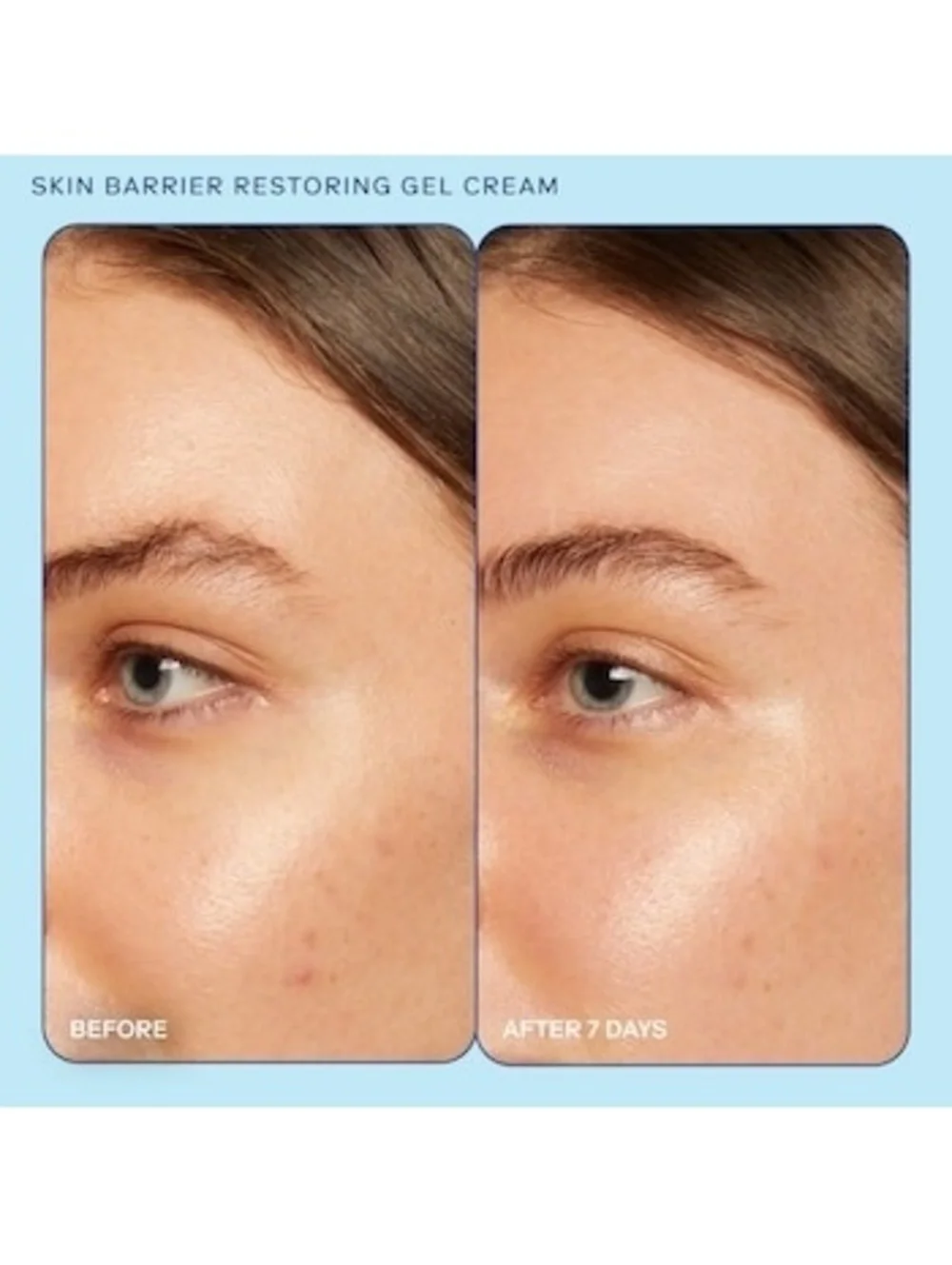 Skinfix barrier+ skin